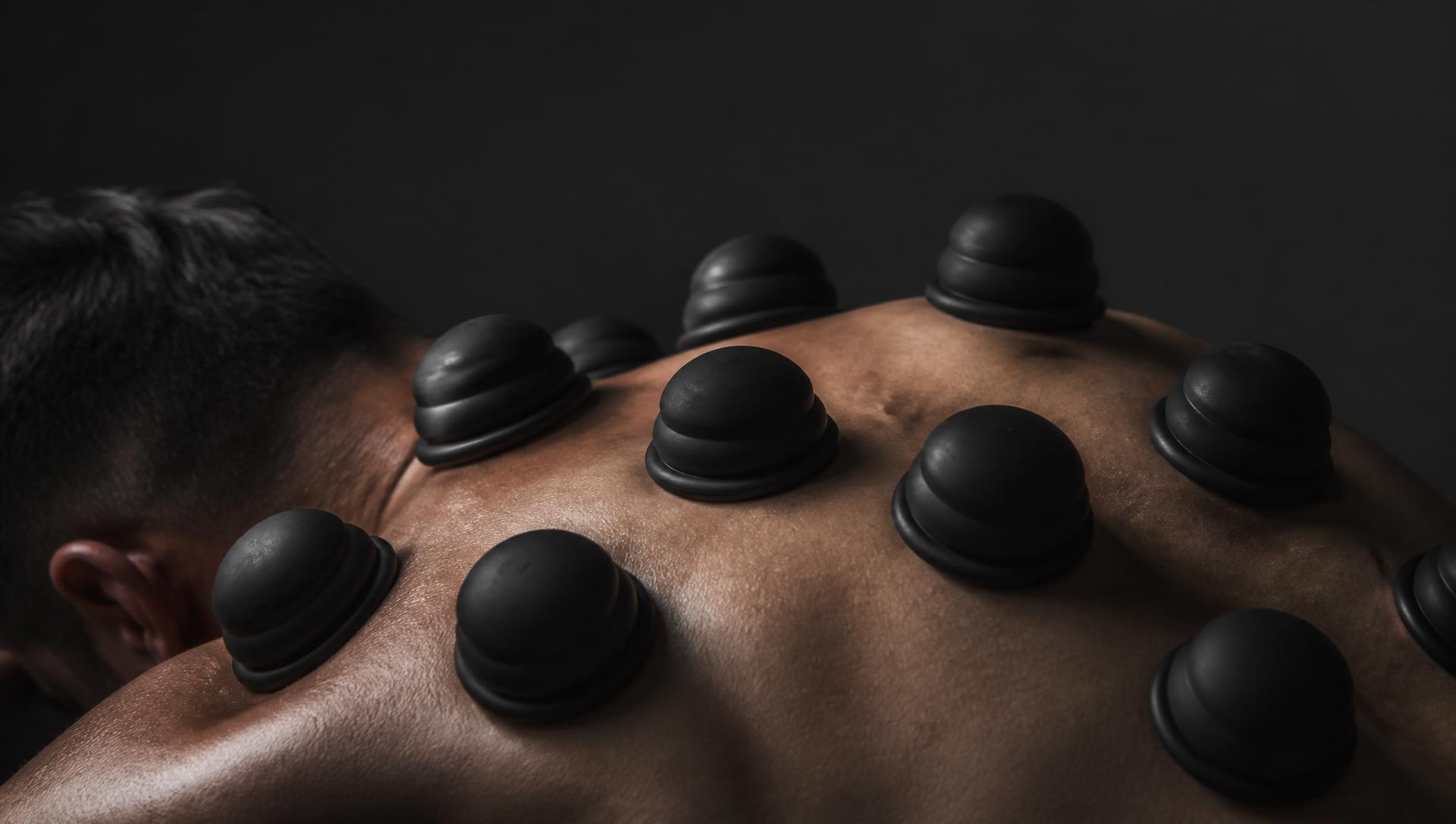 Cupping-behandeling op de rug van een atleet